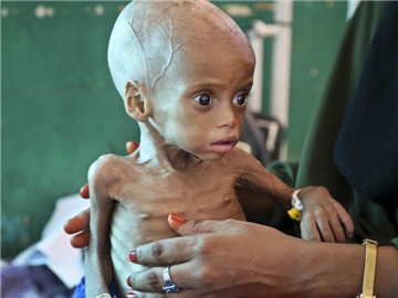 20 Millionen Menschen in vier Ländern sind vom Hungertod bedroht. Foto: Mohamed Sheikh Nor