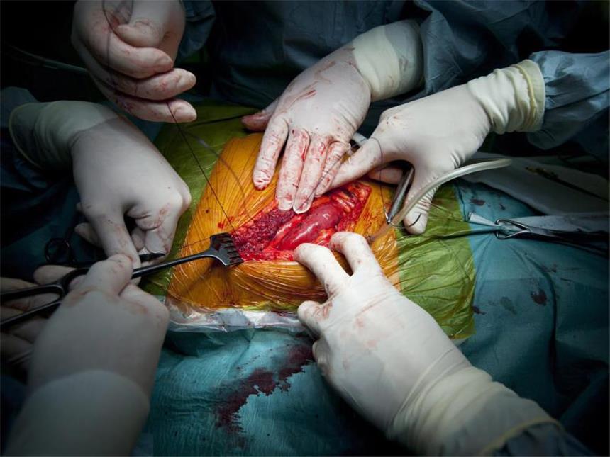 «Stern»: Organempfänger haben in Deutschland schlechtere Prognose Ärzte verschließen nach einer Nierentransplantation die Wunde. Foto: Balazs Mohai/Archiv