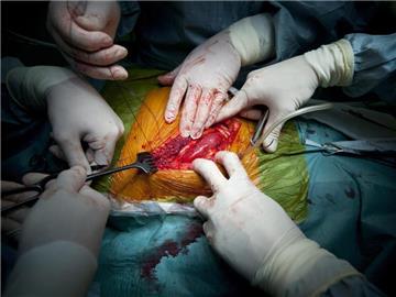 Ärzte verschließen nach einer Nierentransplantation die Wunde. Foto: Balazs Mohai/Archiv