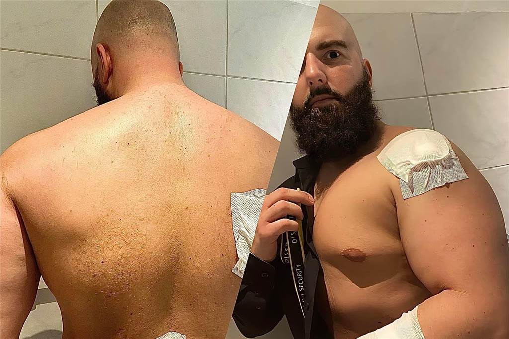 Verteidigung „fast unmöglich“: Wie gefährlich ist ein Messerangriff, Herr Dimi? Ahmad Dimi, der Chef der Dortmunder Sicherheitsfirma D.I.S.S Int. Security Service, trug nach einem Messerangriff im Jahr 2021 fünf Stiche davon.