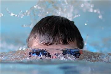 Auch nach einem Kreuzbandriss kann man Sport treiben. Schwimmen zum Beispiel eignet sich dann gut. Foto: Fredrik von Erichsen
