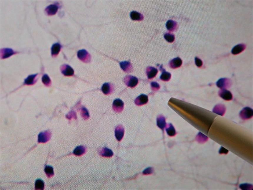 Immer weniger Spermien bei europäischen Männern Auf einem Computerbildschirm wird ein Spermiogramm angezeigt. Forschern zufolge ist der Rückgang der Spermienanzahl "stark und anhaltend". Foto: Jan Woitas
