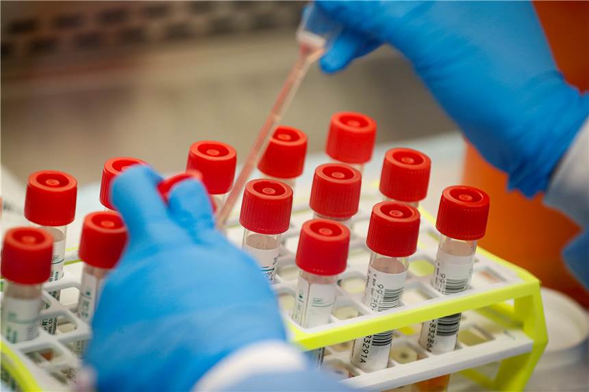 Coronavirus: Zahl der Infizierten im Kreis leicht erhöht, kein Fall in Werne Bei 19 Personen im Kreis Unna ist die Covid-19-Erkrankung nachgewiesen. In Werne gibt es Stand Sonntagnachmittag, 15. 3., noch keinen Fall.