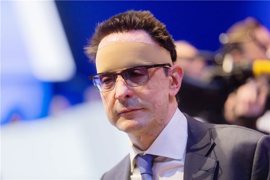Säure-Anschlag auf Innogy-Manager: Prozess startet in Wuppertal Bernhard Günther, damaliger Finanzvorstand von Innogy, bei der Hauptversammlung von Thyssenkrupp im Jahr 2020. Auch Jahre nach dem Anschlag ist er noch schwer gezeichnet.
