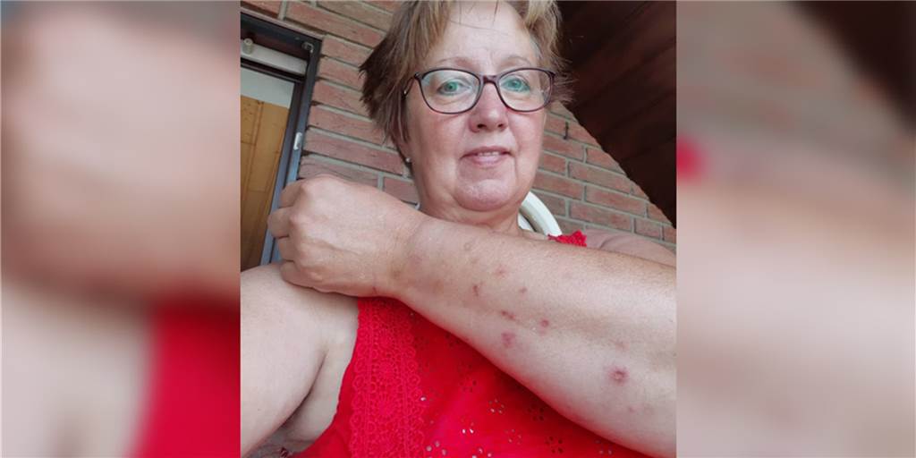 Eichenprozessionsspinner in Haltern: „Momentan ist es eine wirkliche Epidemie“ Eichenprozessionsspinner in Haltern: „Momentan ist es eine wirkliche Epidemie“