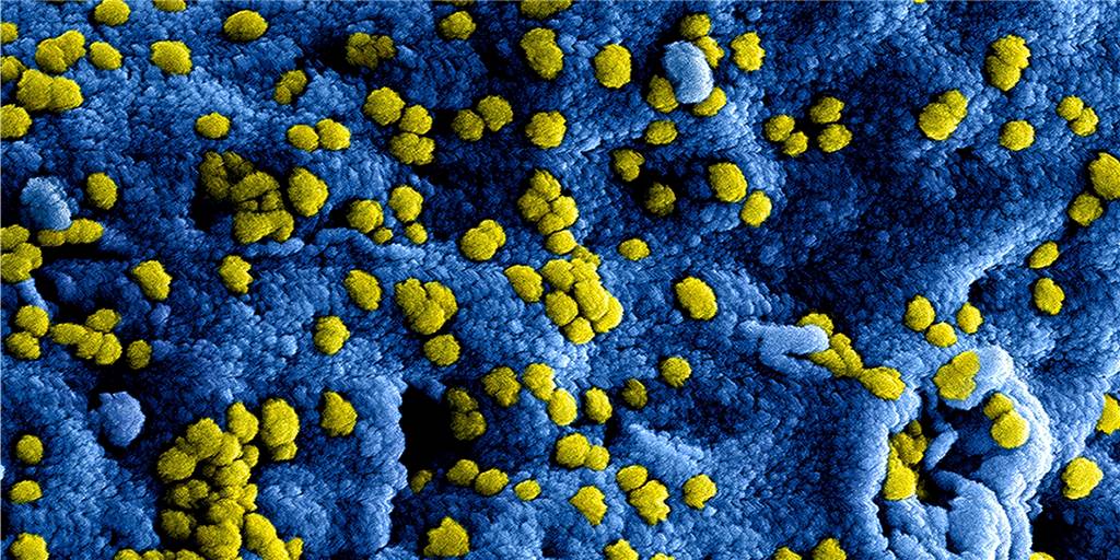 Das Coronavirus breitet sich weiter aus. Wir haben die wichtigsten Fragen und Antworten zusammengetragen.