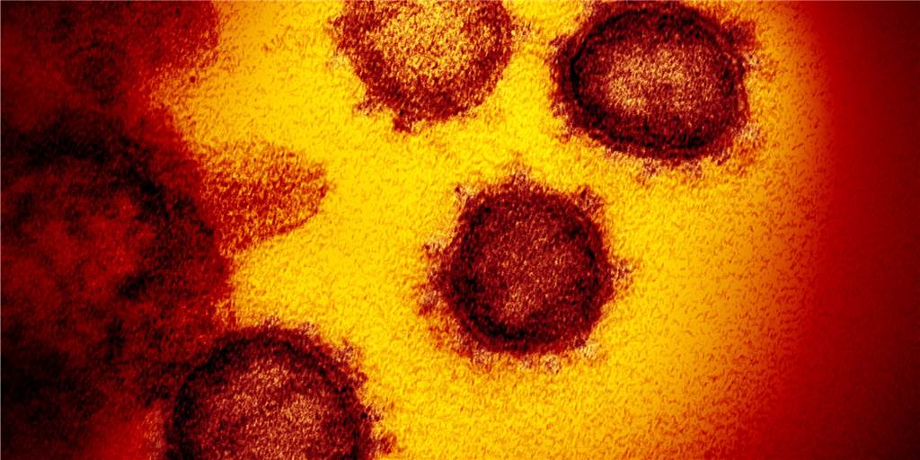 61 Schüler vom Berufskolleg für Technik werden nach Südtirol-Fahrt auf Coronavirus getestet 61 Schülerinnen und Schüler befinden sich aktuell auf Klassenfahrt in Südtirol. Bei ihrer Ankunft in Ahaus werden sie auf das Coronavirus getestet.