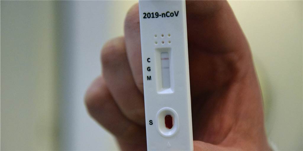 Arzt aus Ahaus begeistert: Test weist nachträglich Coronavirus nach Mit einem einfachen Bluttest kann Dr. Heinz Giesen nun überprüfen, ob ein Patient mit dem Coronavirus infiziert war oder nicht.