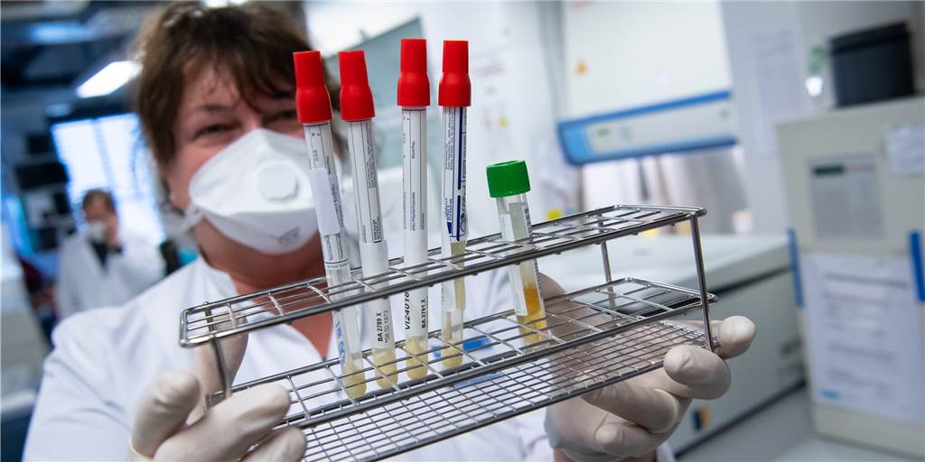 Corona-Tote: Dortmund nennt alternative Zahlen – Streit mit RKI und Land Laborproben auf den Corona-Virus. Ein positiver Laborbefund ist Voraussetzung für die Aufnahme in die RKI-Statistik.