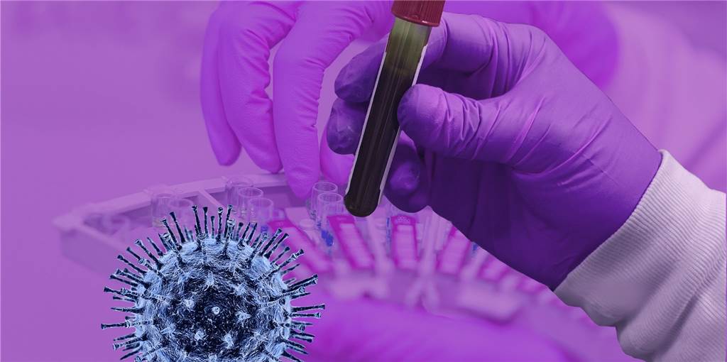 Infizierte Schlachthof-Mitarbeiter: Heek hat viel Glück im Unglück Die tägliche Kontrolle der jüngst mit dem Coronavirus Infizierten in Heek ist deutlich komplexer als üblich.