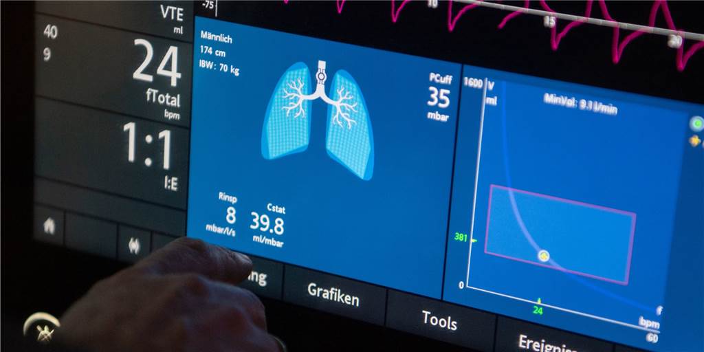 Kreis Unna: Kein einziger Corona-Patient mehr auf der Intensivstation Ein Arzt bedient eine Beatmungsmaschine auf einer Intensivstation. Das ist im Kreis Unna gerade nicht mehr notwendig.