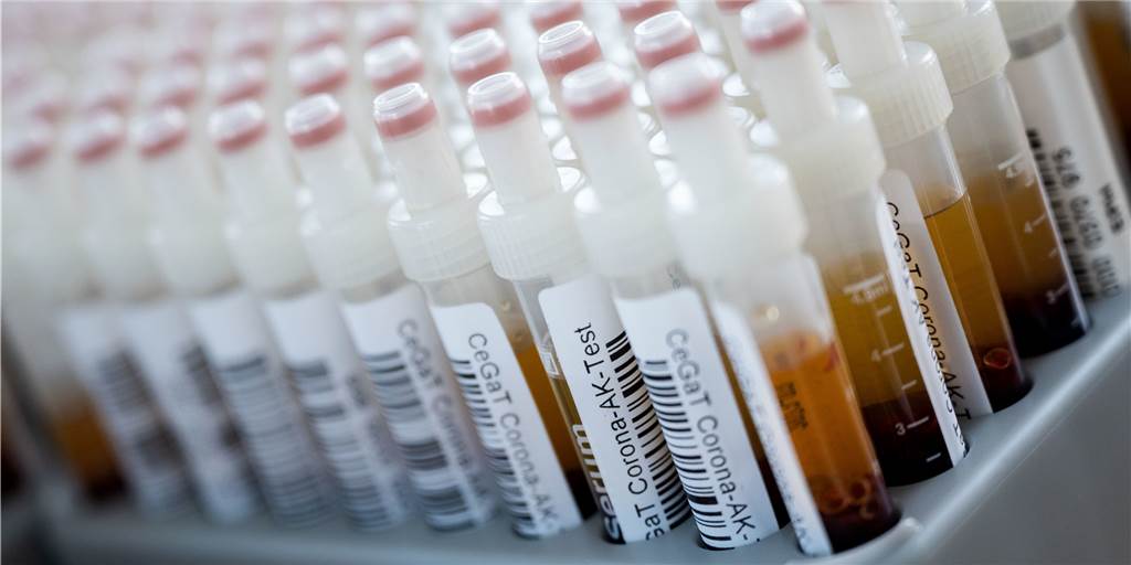 SuS Olfen trifft Entscheidung, wie es wegen des Coronavirus weitergeht SuS Olfen trifft Entscheidung, wie es wegen des Coronavirus weitergeht
