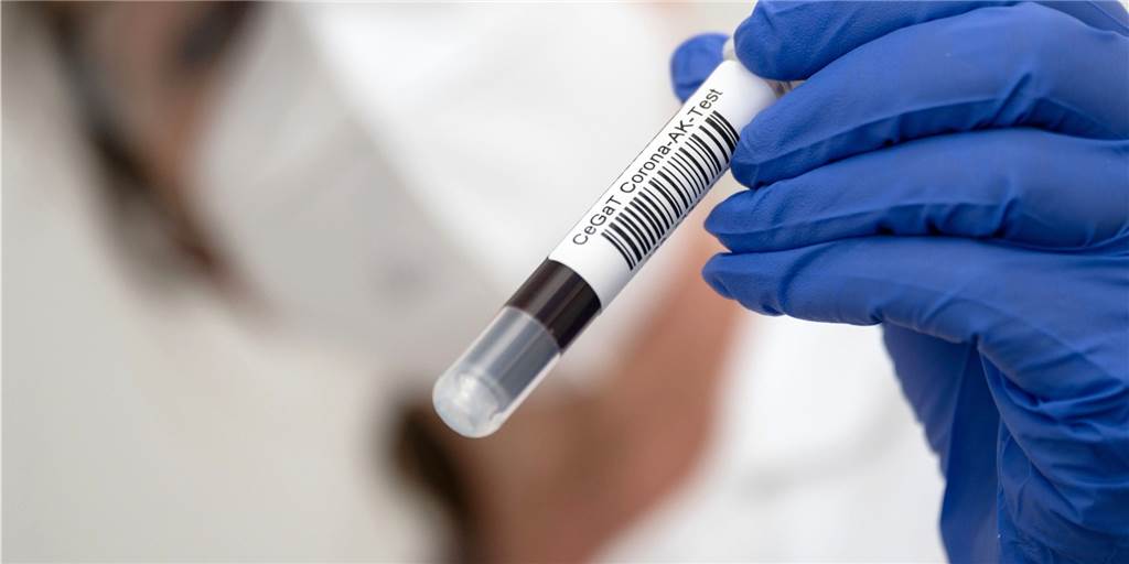 Klinikum Dortmund untersuchte tausende Blutspenden auf Corona-Antikörper Wer im September im Klinikum Dortmund Blut gespendet hat, konnte sich kostenlos auf Corona-Antikörper testen lassen. (Symbolbild)