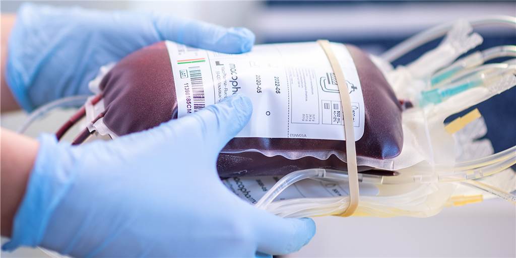 Corona-Antikörper unter Blutspendern: Wert höher als der Dortmund-Schnitt Die Analyse der Blutspenden gibt einen Hinweis darauf, wie verbreitet das Coronavirus in der Bevölkerung ist.