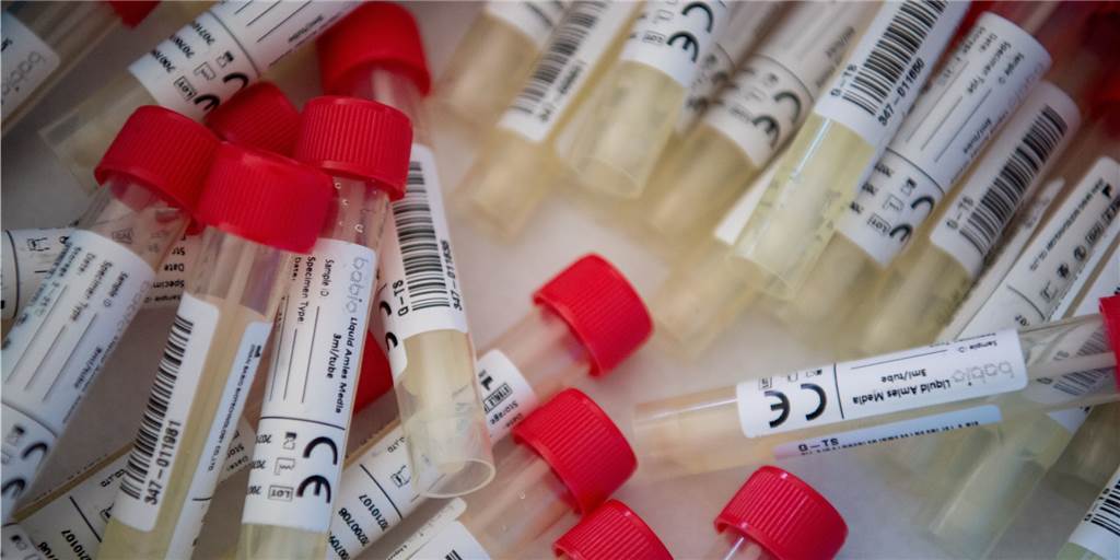 Infektion mit Delta-Variante - Borkener Vater steckte Familie an Infektion mit Delta-Variante - Borkener Vater steckte Familie an