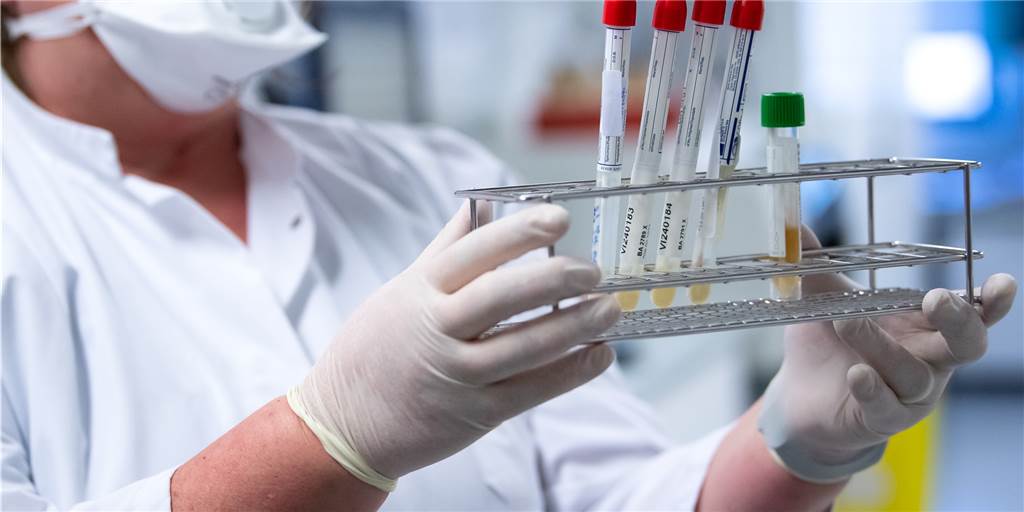 Feiern geht nur mit PCR-Test – Aber wo bekommt man den in Haltern? PCR Tests werden in der Regel im Labor durchgeführt.