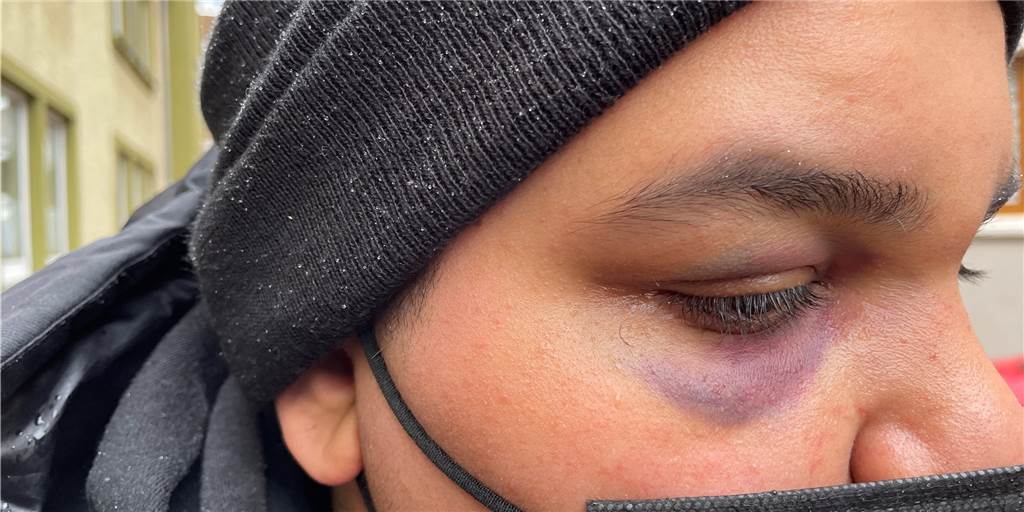 Nach Prügelattacke in Dorsten: Polizei lädt mutmaßlichen Schläger vor Nach Prügelattacke in Dorsten: Polizei lädt mutmaßlichen Schläger vor
