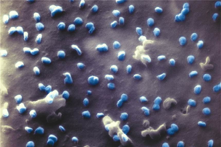 Dominierende Coronavirus-Variante B.1.1.7: Die wichtigsten Fragen und Antworten Coronaviren (blau) beim Austritt aus einer Nierenzelle, aufgenommen mit einem Heliumionen-Mikroskop. Die britische Corona-Mutation ist inzwischen die vorherrschende Variante in Deutschland.