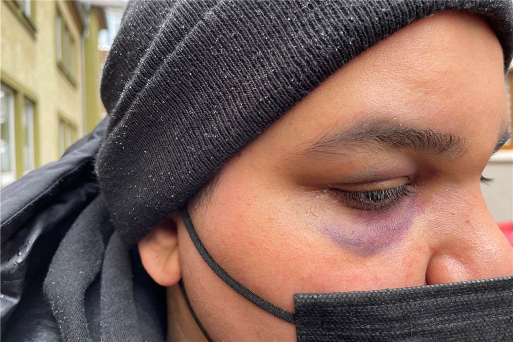 Das Auge blutunterlaufen, Nasenbein und Jochbein gebrochen. Die Mütze verdeckt einige Schwellungen am Kopf, die Noreen Elahi ebenfalls erlitten hat.