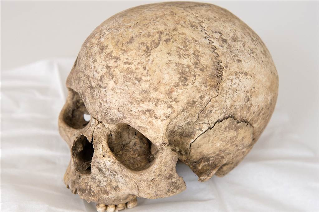 Schädelfund in Haltern: Was Knochen Experten verraten - und was nicht Das ist nicht der im Kanal gefundene Schädel. Er könnte jedoch ähnlich aussehen. Dieser wurde 2016 bei Friedhofsausgrabungen in Sachsen gefunden.