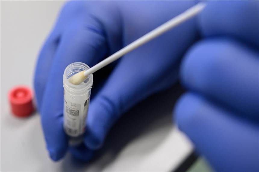 Erste bestätigte Coronavirus-Infektion im Kreis Borken – Frau aus Bocholt infiziert Der Kreis Borken hat am Donnerstagmorgen den ersten Fall einer Coronavirus-Infektion im Kreis bestätigt.