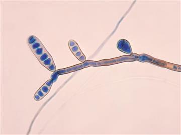 Der Pilz fungus Exserohilum rostratum, mit dem das Medikament verunreinigt war. Die Meningitiswelle in den USA weitet sich immer weiter aus. Foto: Centers for Disease Control and Prevention (CDC)