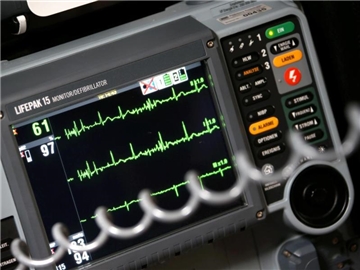 Der Sinusrhytmus eines Herzens ist bei einem Notfalleinsatz auf einem EKG zu sehen. Foto: Stephan Jansen