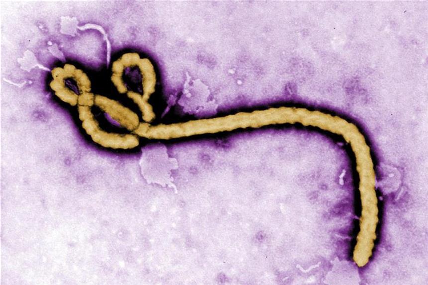 Ebola-Ausbruch im Kongo: Mehr als 1000 Menschen geimpft Die Aufnahme eines Elektronenmikroskops zeigt ein Partikel des Ebola-Virus. Foto: Frederick Murphy/CDC/AP