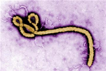 Die Aufnahme eines Elektronenmikroskops zeigt ein Partikel des Ebola-Virus. Foto: Frederick Murphy/CDC/AP