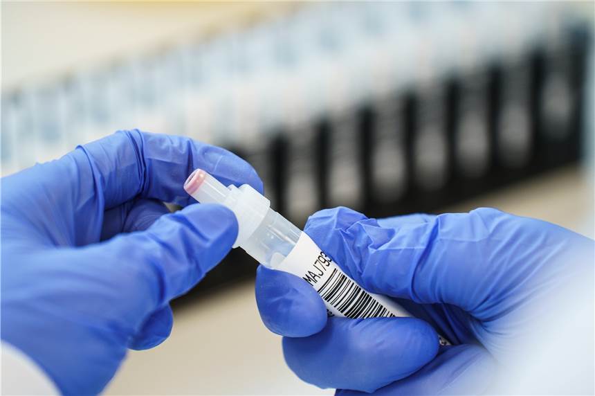 Die britische B.1.1.7-Mutation des Coronavirus ist nun in Werne angekommen.