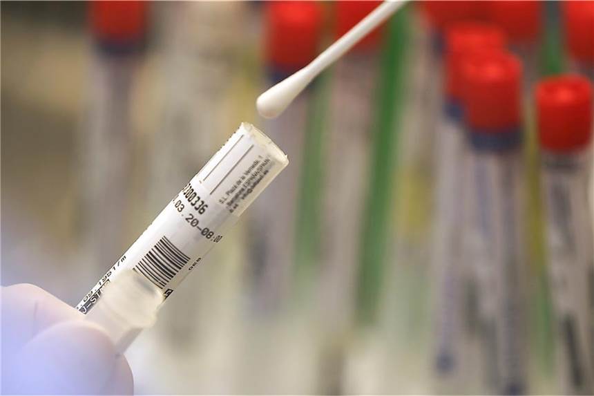 Britische Corona-Mutation im Kreis Borken nachgewiesen Die britische Mutation des Coronavirus ist im Kreis Borken angekommen. (Symbolbild)