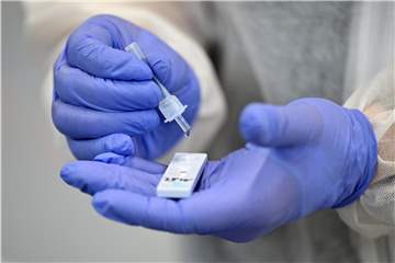 Zwei Hände in Gummihandschuhen mit einem Corona-Schnelltest