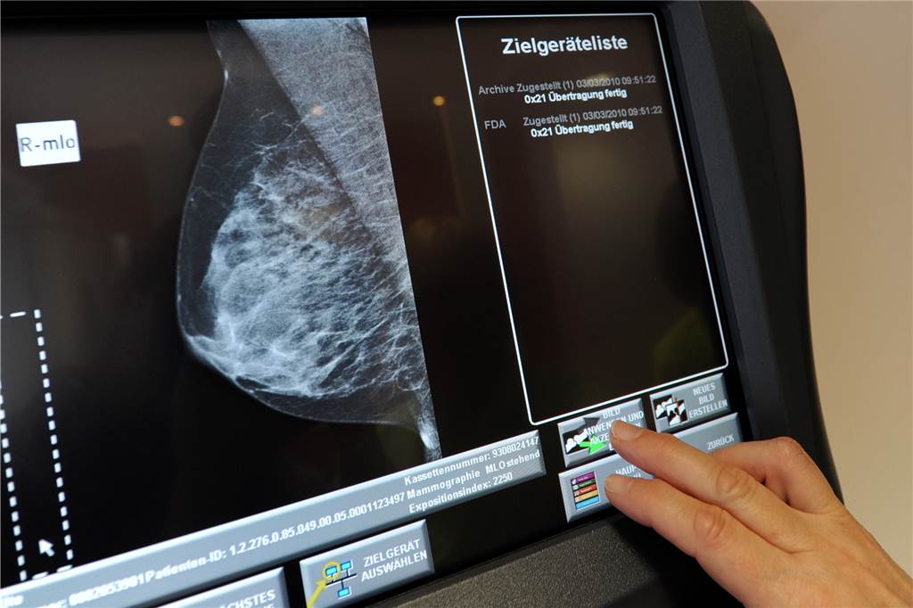 Mammographie einer weiblichen Brust