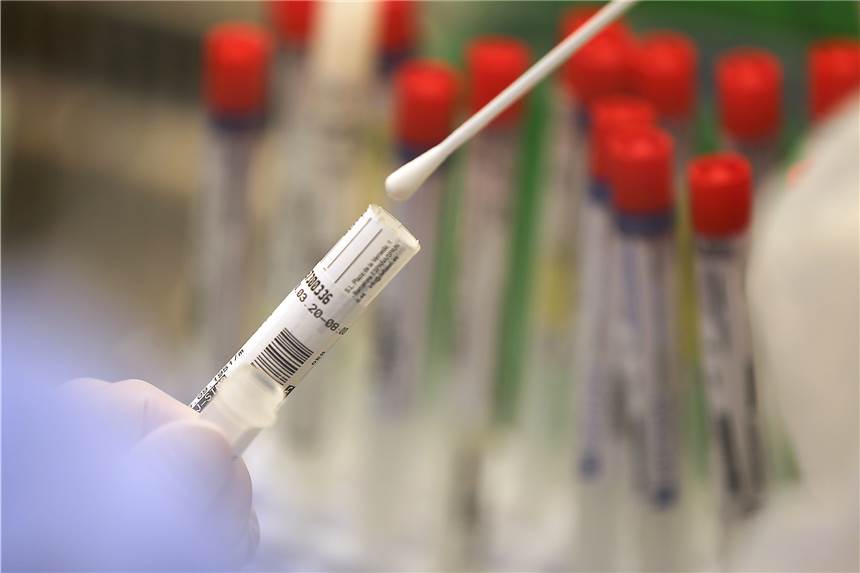 Coronazahlen: 7-Tage-Inzidenz kratzt jetzt an der 150er-Grenze Die Zahl der positiven Corona-Tests geht im Wochenvergleich zurück. Dadurch sinkt die Inzidenz.
