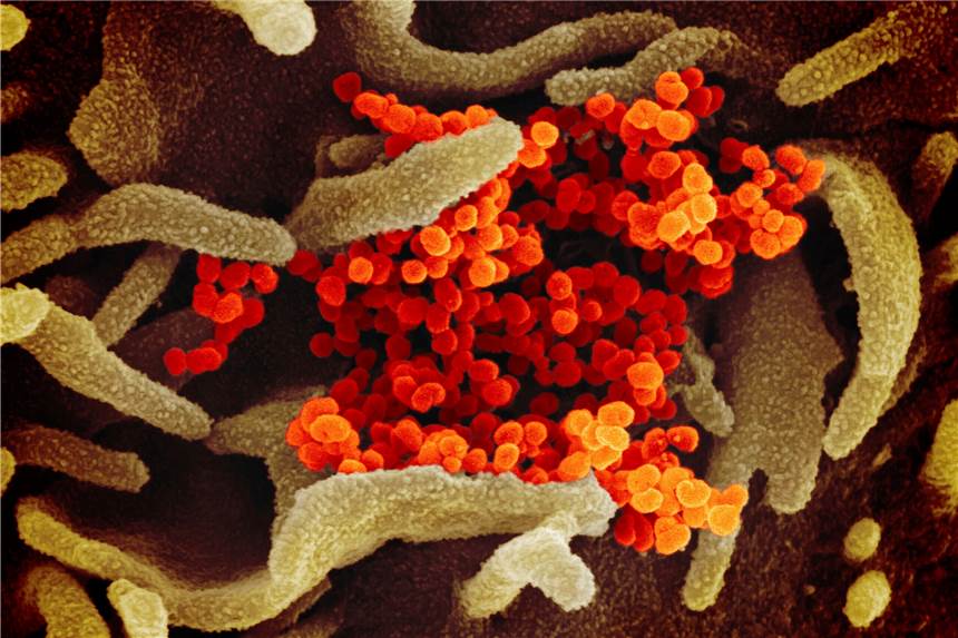 Kann sich das Coronavirus doch im menschlichen Erbgut einnisten? Diese rasterelektronenmikroskopische Aufnahme zeigt SARS-CoV-2 (orange), das COVID-19 verursacht, das aus der Oberfläche von im Labor kultivierten Zellen (grün) austritt. Isoliert wurde das Material von einem Patienten in den USA.