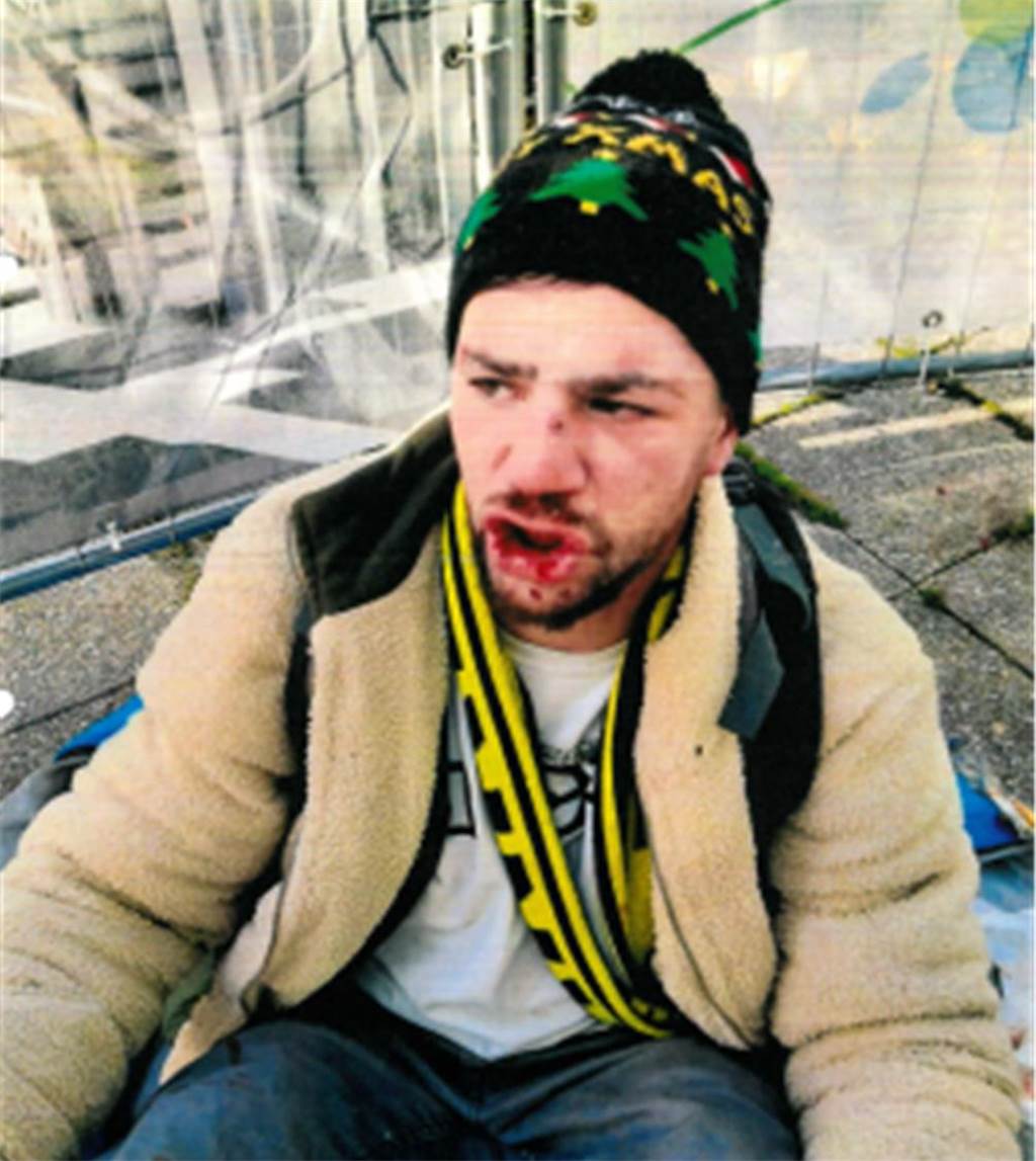 Mann stirbt nach Faustschlägen: Polizei sucht nach Krystian Denis Wieclawek Dieser Mann wird beschuldigt, einen anderen so schwer geschlagen zu haben, dass dieser starb. Die Polizei sucht nach ihm und bittet um Zeugenhinweise - warnt jedoch davor, den Verdächtigen anzusprechen.