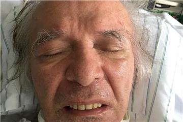 Dieser unbekannte Mann liegt seit einem Sturz beim Joggen am 13. März im Volkspark Wilmersdorf im Koma. Seitdem versucht die Berliner Kripo die Identität des Mannes zu klären. Foto: Polizei Berlin