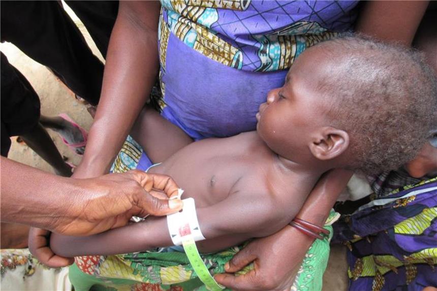 Unicef: 770.000 Kinder im Kongo unterernährt Ein Baby wird gewogen und vermessen, um den Grad seiner Unterernährung zu ermitteln. Foto: Kate Bartlett