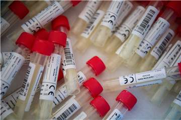 Ein Borkener Vater hat seine Familienmitglieder mit der Delta-Variante des Coronavirus angesteckt.