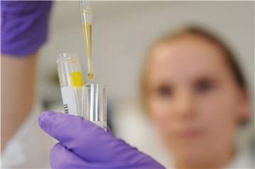Eine Biologisch Technische Assistentin (BTA) untersucht im Bernhard-Nocht-Institut für Tropenmedizin (BNI) in Hamburg eine eingegangene Probe auf das Hanta-Virus.