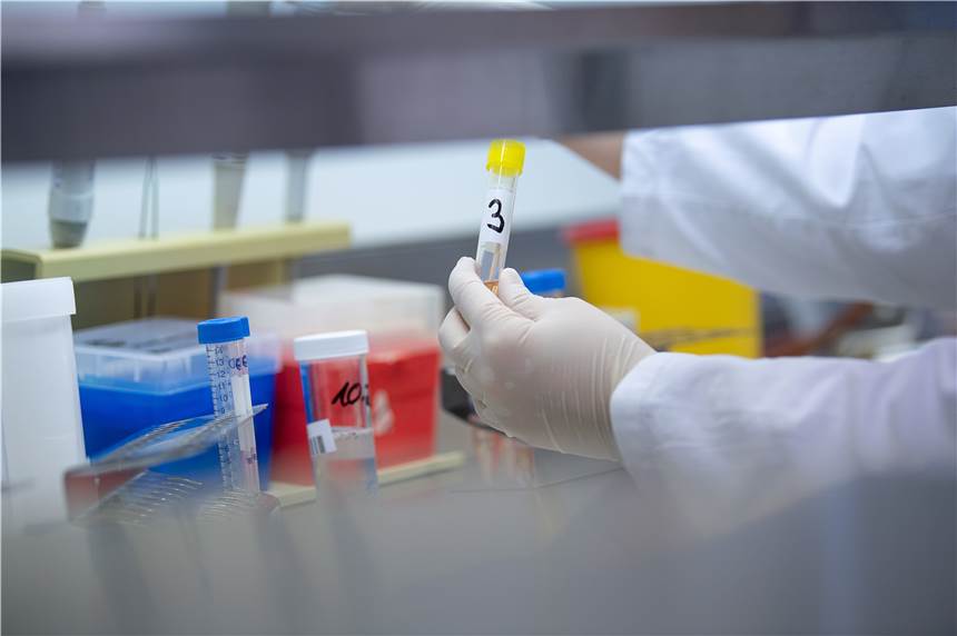 Coronavirus: Bestätigter Fall in Dorsten - Frau positiv getestet Eine Frau aus Dorsten ist positiv auf das Coronavirus getestet worden (Symbolbild).