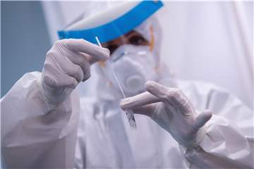 Eine Frau hält in einem Covid-19 Testcenter die Probe von einem Rachenabstrich in den Händen. 