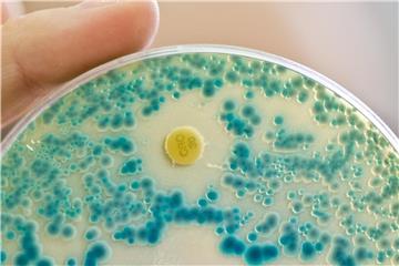 Eine Labormitarbeiterin am Institut für Klinische Mikrobiologie, Immunologie und Hygiene des Universitätsklinikums Erlangen hält eine Indikator-Kulturplatte zum Nachweis von resistenten Bakterien in der Hand. Foto: Daniel Karmann/Archiv