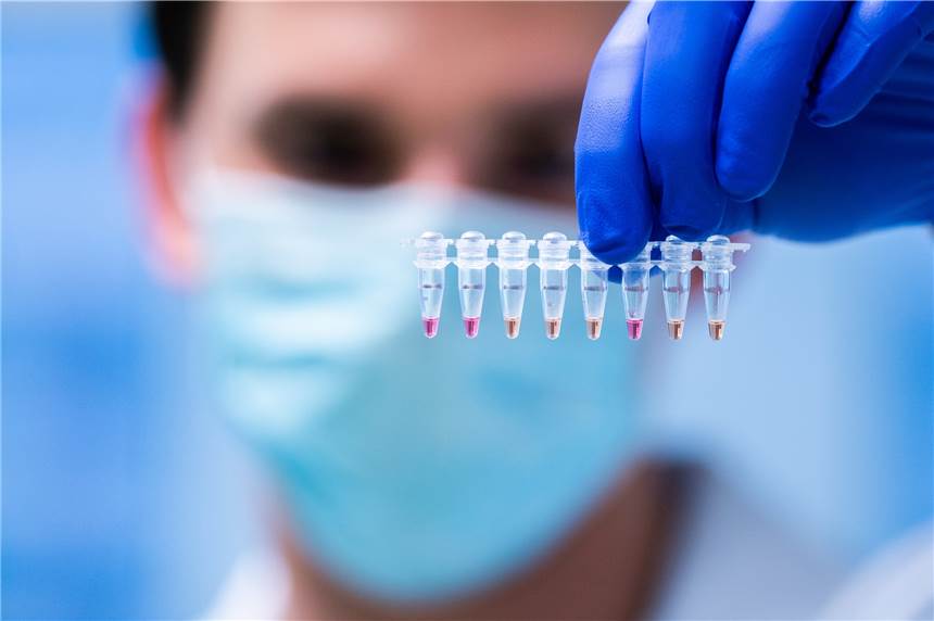 Coronavirus: 101 neue positive Fälle im Kreis Recklinghausen Im Kreis Recklinghausen gibt es 101 neue positive Corona-Fälle.