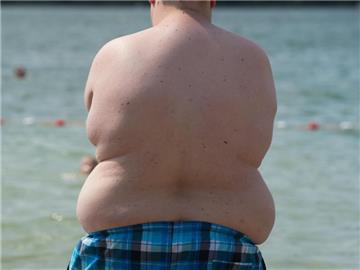 Im vergangenen Jahr waren weltweit 124 Millionen Kinder deutlich zu dick. Foto: Sebastian Kahnert