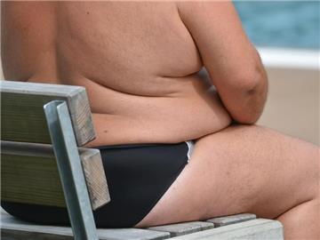 In Deutschland ist dem "XXL-Report" der DAK zufolge jeder vierte Erwachsene zwischen 18 und 79 fettleibig. Foto: Franziska Kraufman