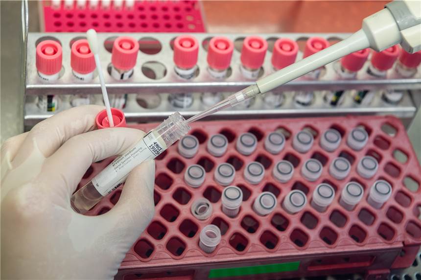 Erster Fall in Legden: Coronavirus breitet sich weiter aus In Legden wurde am Montag, 16. März, der erste Corona-Fall bestätigt.
