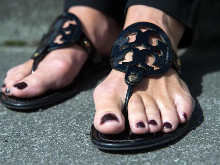 Fußgymnastik, Schienen oder OP? Was beim Hallux valgus hilft In Sandalen fühlen sich Frauen mit ausgeprägtem Hallux valgus häufig am wohlsten. Denn die schiefstehende große Zehe drückt in geschlossenen Schuhen. Unbehandelt führt ein Hallux valgus häufig auch zu Knieschmerzen. Foto: Andrea Warnecke/dpa-tmn