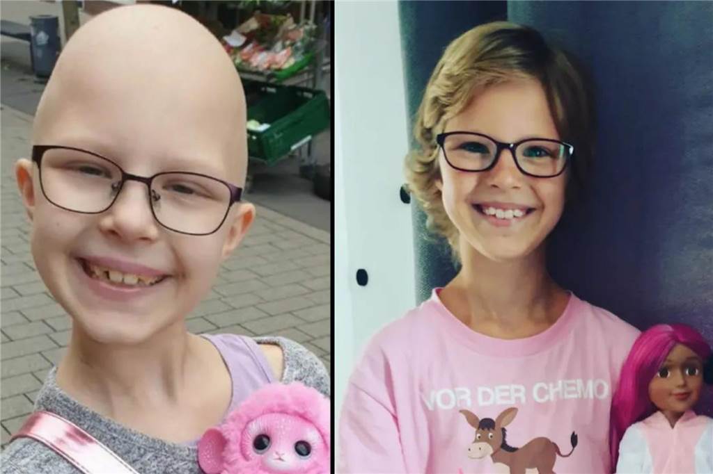 Liah (8) hat den Krebs besiegt: „Wir sind sehr stolz auf unsere Kämpferin“ Liah während der Chemotherapie im Jahr 2021 und danach im Sommer 2022.