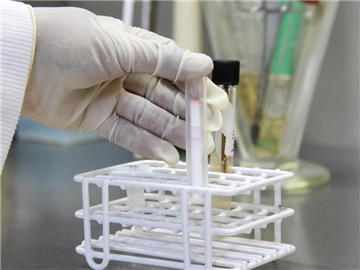m Institut Pasteur de Madagascar in Ambatofotsikely wird ein Schnelltest für Pest-Erreger vorgenommen. Foto: Jürgen Bätz